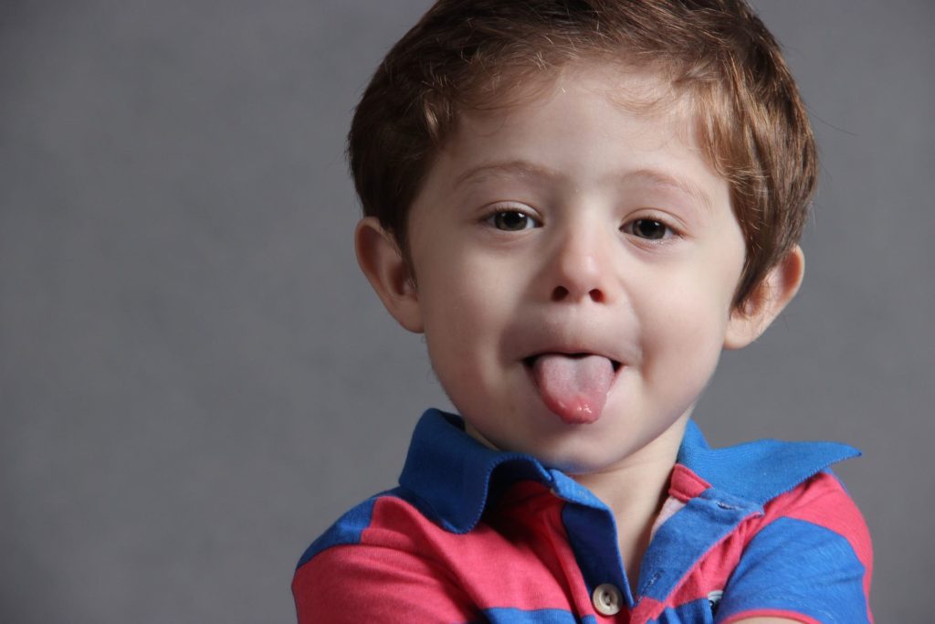 photo d'un petit garçon qui tire la langue après une frénectomie