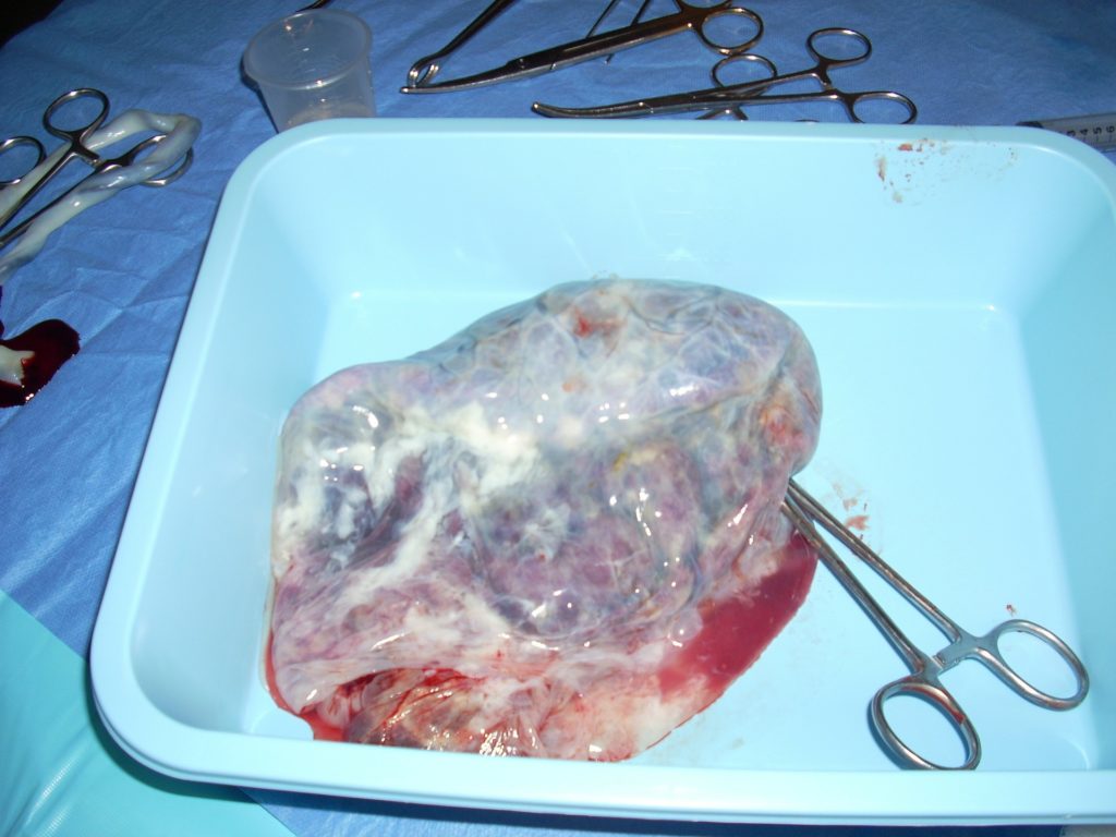 photo d'un placenta